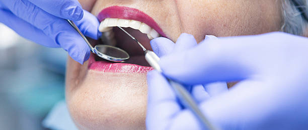 Best Emergency Broken Tooth Repair in Merrillville, IN